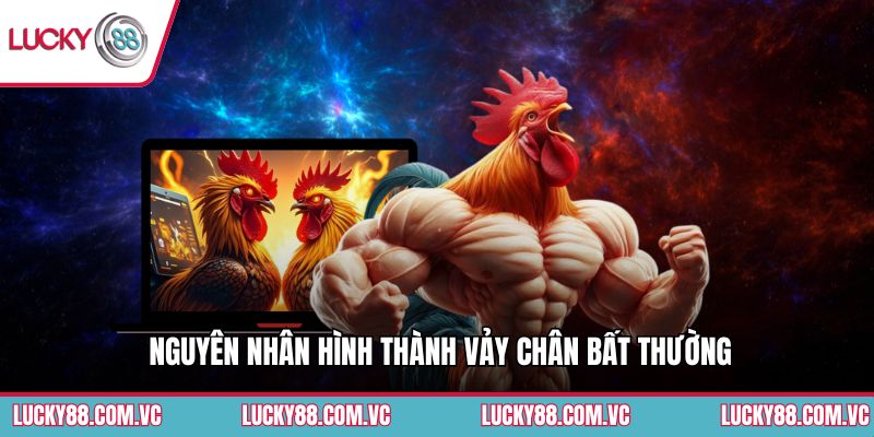 Nguyên nhân hình thành vảy chân bất thường
